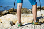 prevent varicose veins